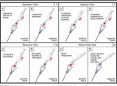 the needle drop testing|[Evaluation of tests performed to confirm the position of the .